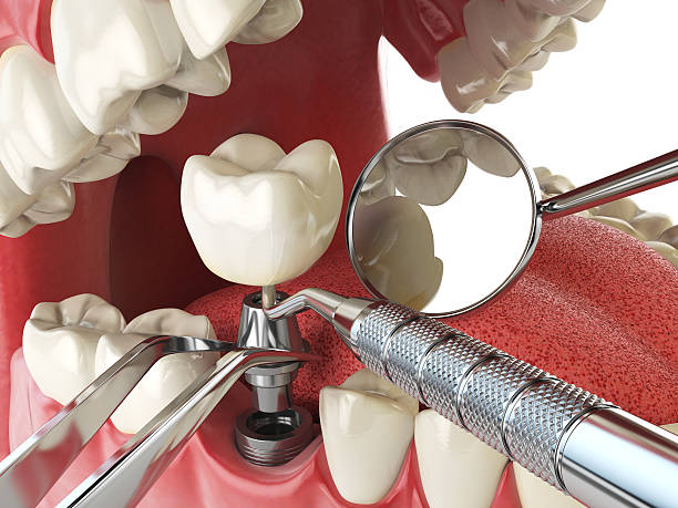 Best Emergency Gum Treatment in Poplar Plains, CT